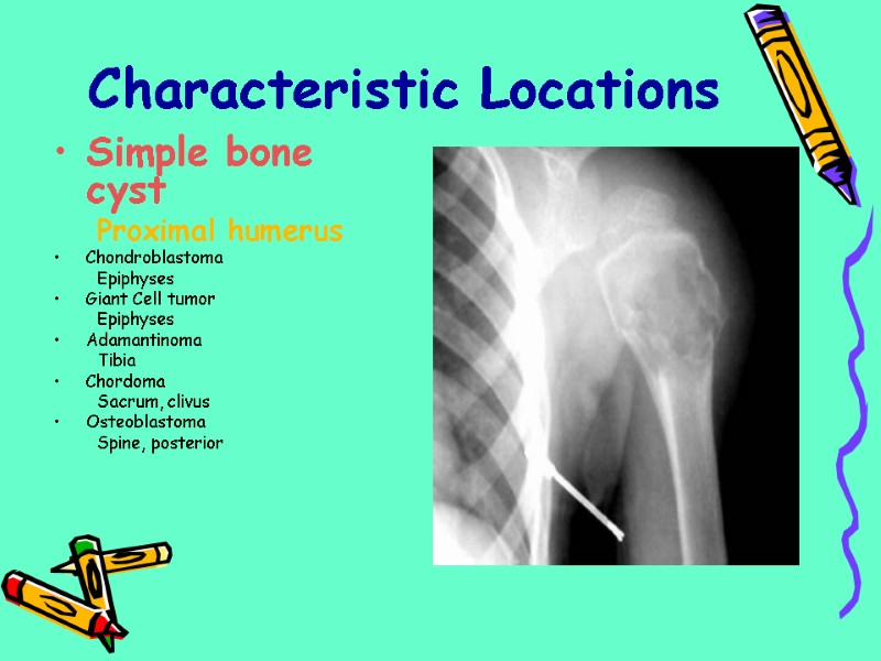 Characteristic Locations Simple bone cyst Proximal humerus Chondroblastoma Epiphyses Giant Cell tumor Epiphyses Adamantinoma